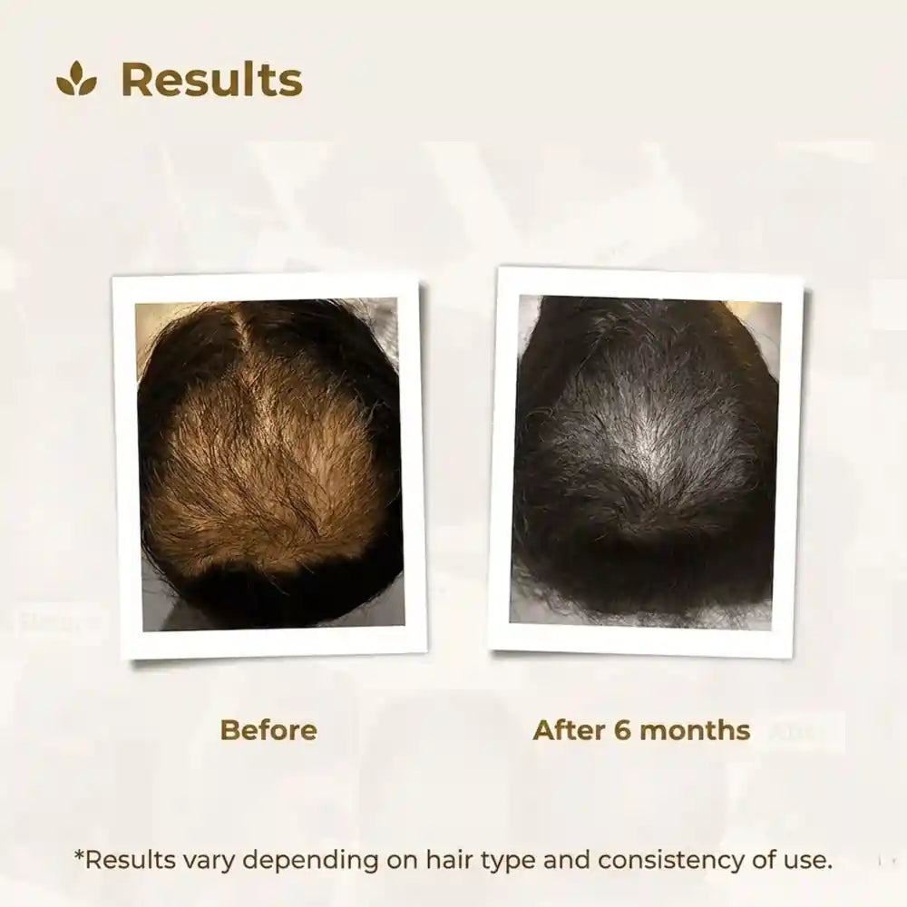 Transformation image of Pakistan's most trusted haircare brand Royallify.