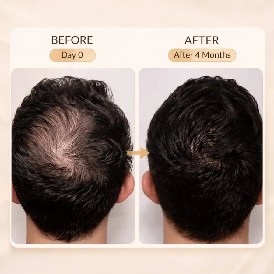 Royallify Hair Growth Shampoo – Helps Reduce Hair Fall - Royallify