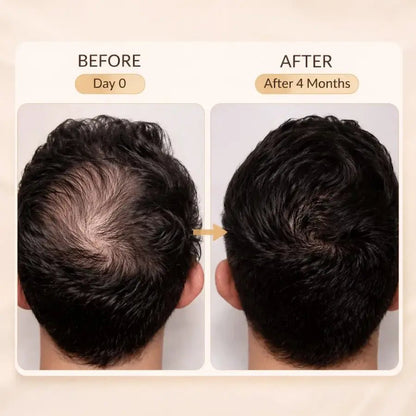 Royallify Hair Growth Shampoo – Helps Reduce Hair Fall - Royallify