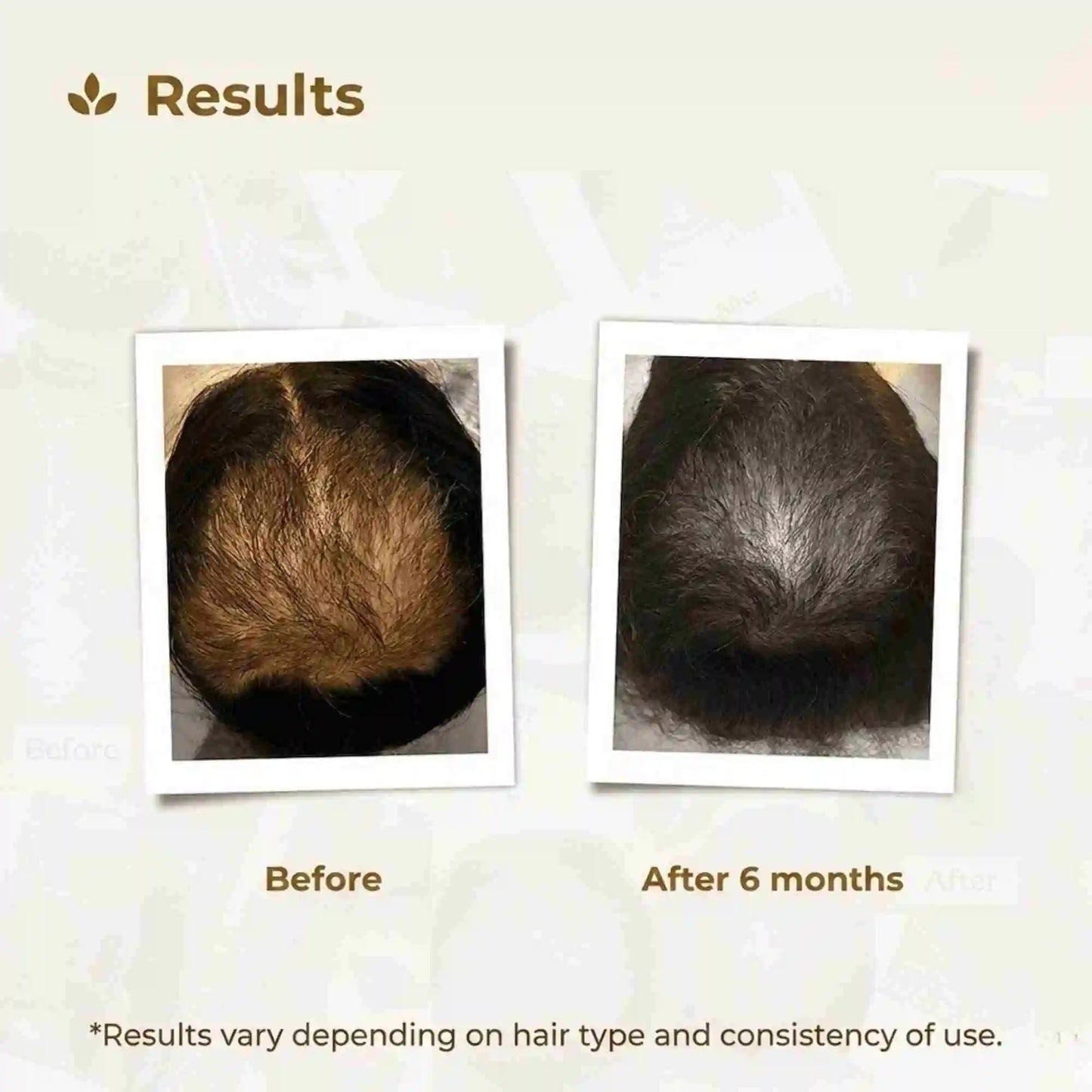 Transformation image of Pakistan's most trusted haircare brand Royallify.