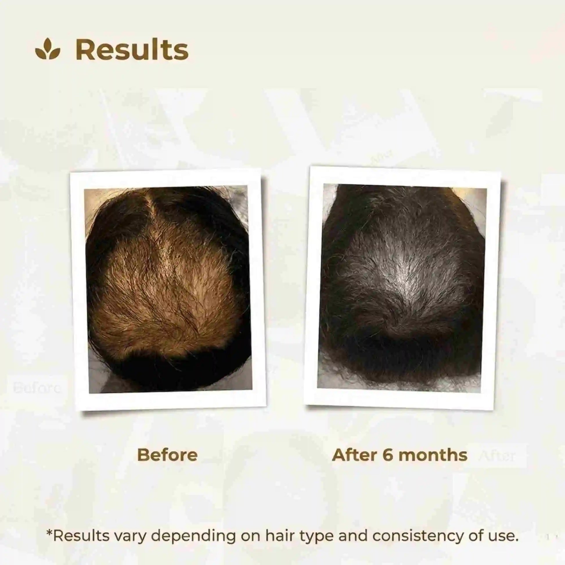 Transformation image of Pakistan's most trusted haircare brand Royallify.