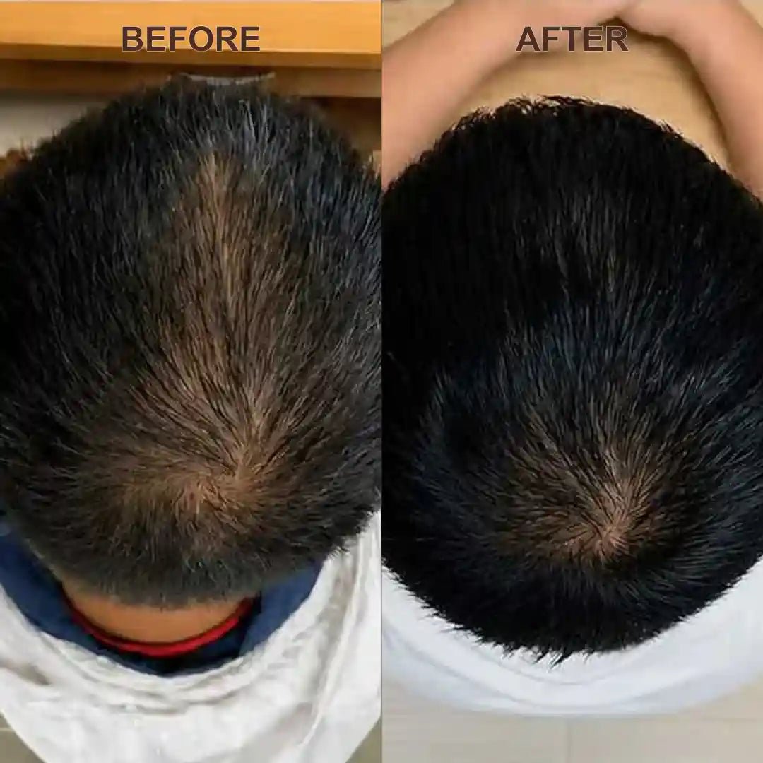 3-in-1 Royallify Scalp Therapy Comb™ - Royallify