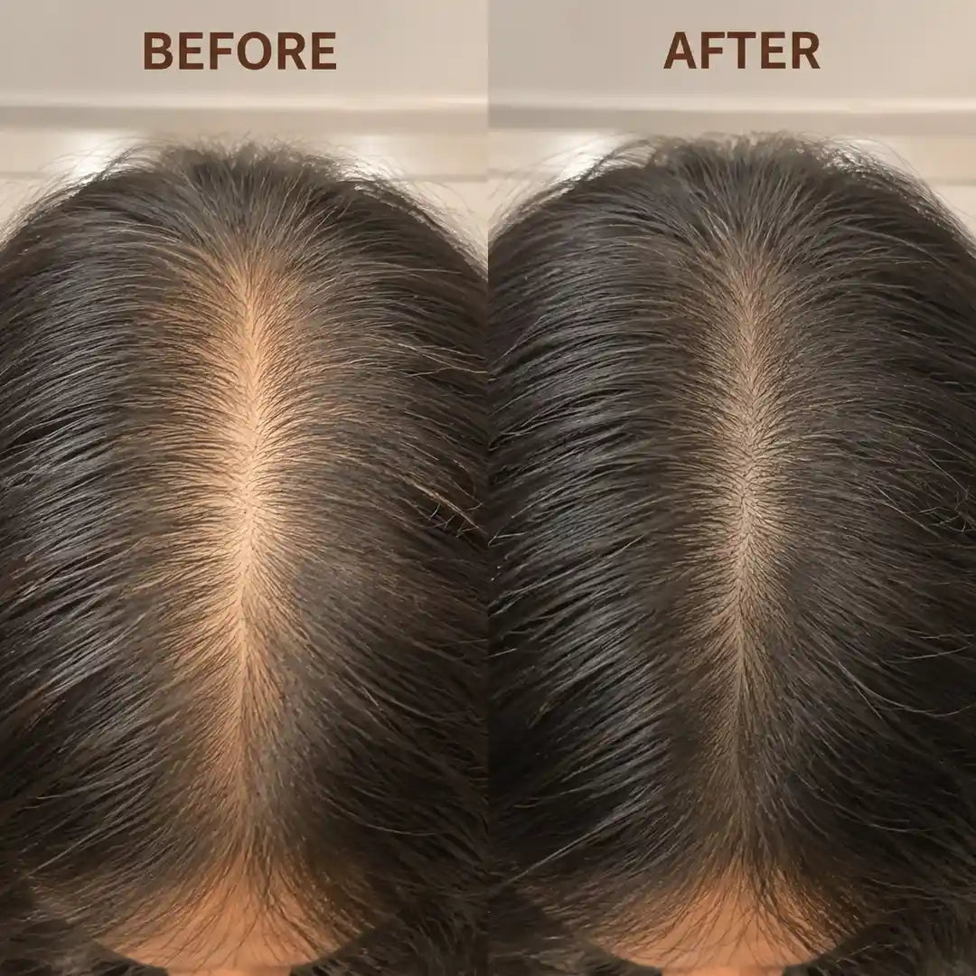 3-in-1 Royallify Scalp Therapy Comb™ - Royallify