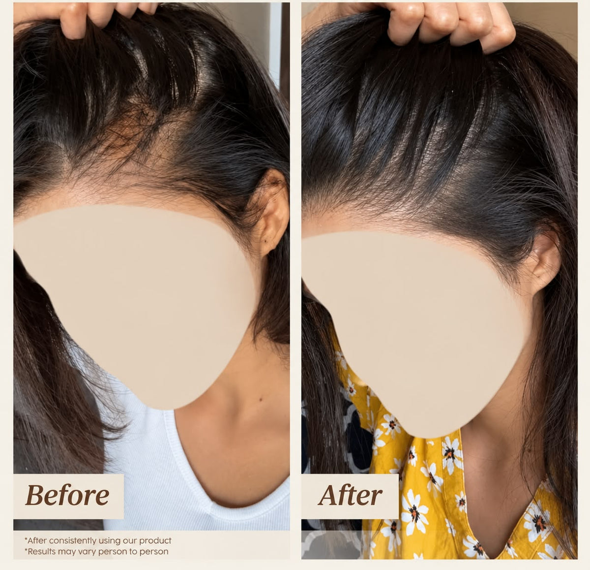 Royallify Hard Water Defense Shampoo - Reduces Hair Fall & Damage - Royallify